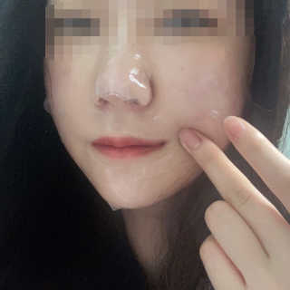 셀더마 마린 콜라겐 하이드로겔 마스크팩 5박스 — 5점을 준 리뷰어가 2020년 3월 올린 사용 사진
