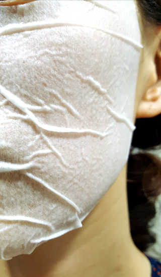 23years old 바데카실 더마실 마스크 — 4점을 준 리뷰어가 2018년 2월 올린 사용 사진