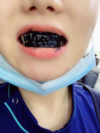 the naked object 디블랙팩치약 디블랙칫솔 세트 — 5점을 준 리뷰어가 2019년 1월 올린 사용 사진
