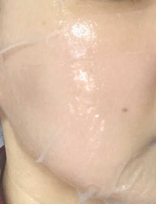 고보습에 화이트닝 아미모네 바다마스크팩 10매입 — 4점을 준 리뷰어가 2019년 11월 올린 사용 사진