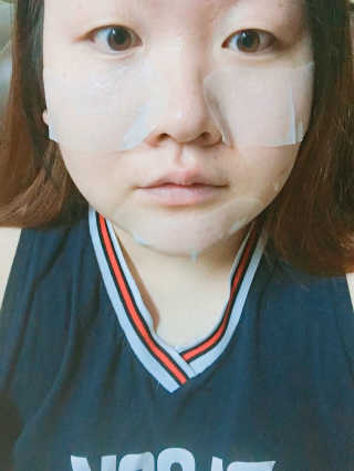 리체 뷰랑셀 케어 스팟 포인트팩 — 4.33점을 준 리뷰어가 2017년 7월 올린 사용 사진