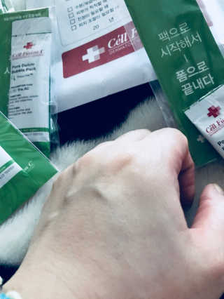 셀퓨전씨 트리악 포어 딜리트 버블 팩 — 4.33점을 준 리뷰어가 2018년 4월 올린 사용 사진