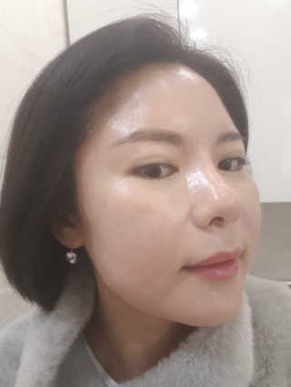 닥터웰메이드원 압구지엔 다이아몬드 링거앰플 — 5점을 준 리뷰어가 2018년 12월 올린 사용 사진