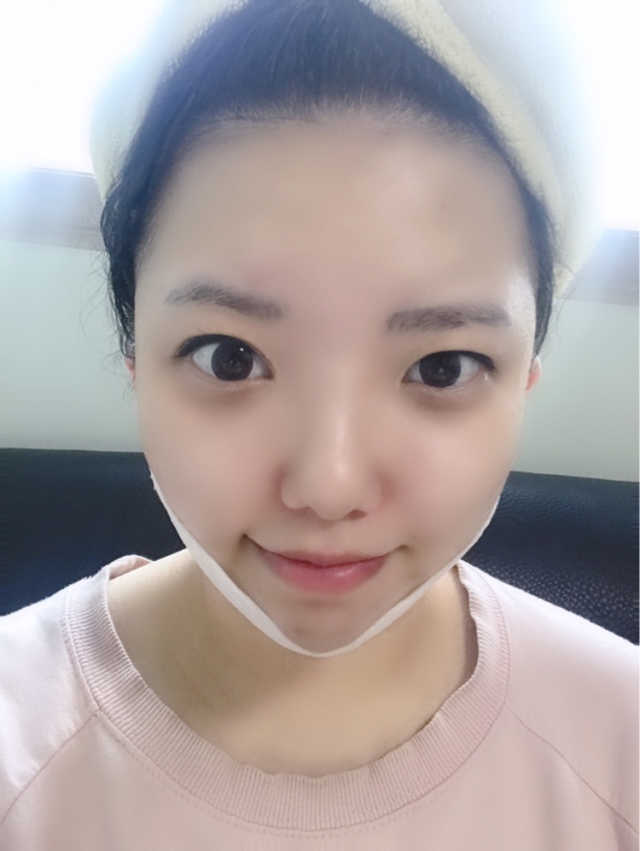 클루덤 리프팅 패치 리뷰 사진