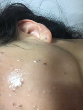 23years old 아쿠아밥 모델링 마스크 — 3.83점을 준 리뷰어가 2018년 8월 올린 사용 사진