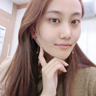 아이디플라코스메틱 아이디 페이스핏 마이너스 밴드 — 2점을 준 리뷰어가 2019년 10월 올린 사용 사진
