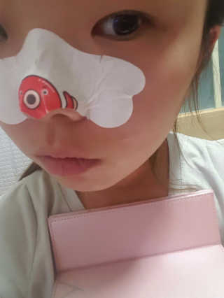 나이팅게일 TAKO PACK NOSE [문어코팩] — 4점을 준 리뷰어가 2016년 12월 올린 사용 사진