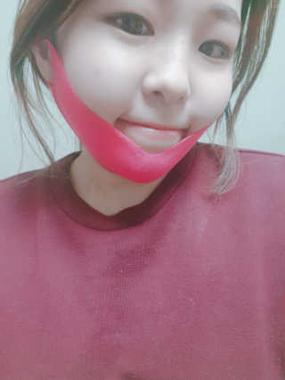 스케덤 펩타이드 리프팅밴드 — 5점을 준 리뷰어가 2019년 3월 올린 사용 사진