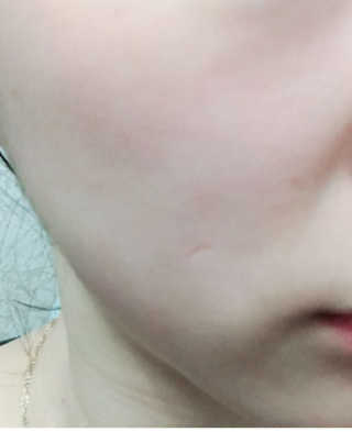 누메로 8 클리어링 모이스처 마스크팩 — 4.5점을 준 리뷰어가 2016년 12월 올린 사용 사진