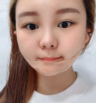아이디플라코스메틱 아이디 페이스핏 마이너스 밴드 — 5점을 준 리뷰어가 2020년 1월 올린 사용 사진