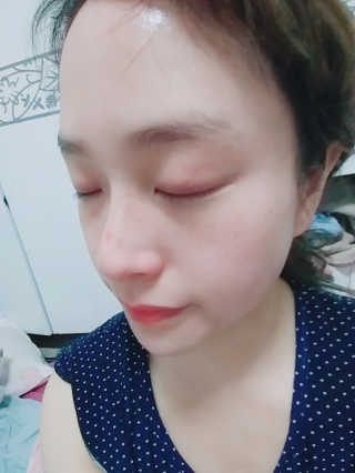 23years old 바데카실 P-오리지널 — 4.67점을 준 리뷰어가 2018년 5월 올린 사용 사진