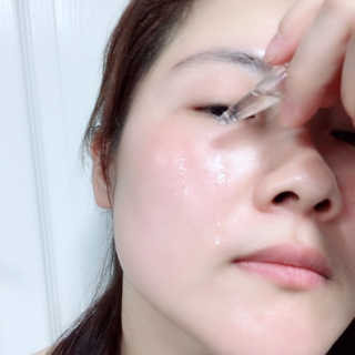 끌라끄네 AC 클리어 3-HA 레드니스 앰플 — 5점을 준 리뷰어가 2019년 2월 올린 사용 사진