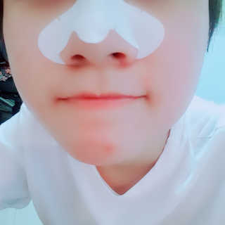미팩토리 3단 돼지코팩 3매입 X 2EA — 5점을 준 리뷰어가 2019년 6월 올린 사용 사진