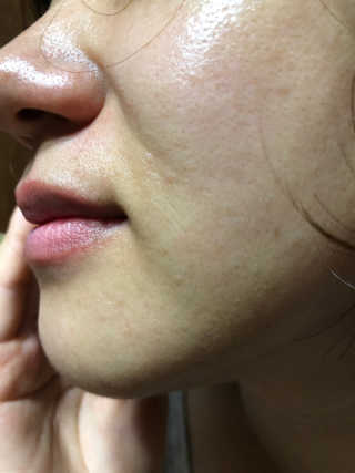 메디페르루테인앰플 3종 — 4.5점을 준 리뷰어가 2019년 8월 올린 사용 사진