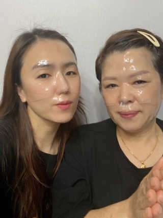 어셀리 브릴리언스 솔루션 하이드로겔 페이셜 마스크 — 2.5점을 준 리뷰어가 2020년 1월 올린 사용 사진