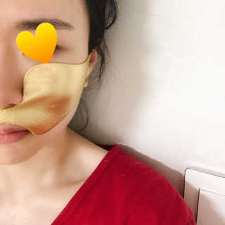 [스케덤] 상악밴드 — 3점을 준 리뷰어가 2019년 7월 올린 사용 사진