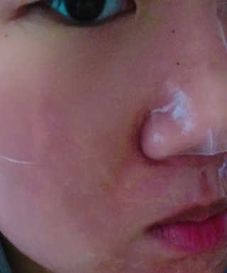 더메이블 라벤더 스킨 릴리프 하이드로겔 마스크 — 4점을 준 리뷰어가 2018년 12월 올린 사용 사진