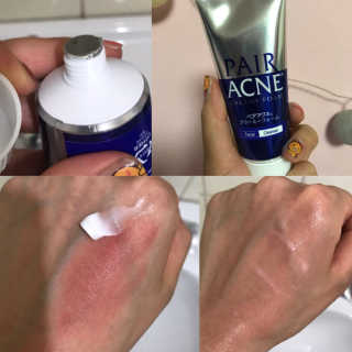 페어아크네 크리미폼 페어아크네 크리미 폼 — 3.5점을 준 리뷰어가 2019년 7월 올린 사용 사진