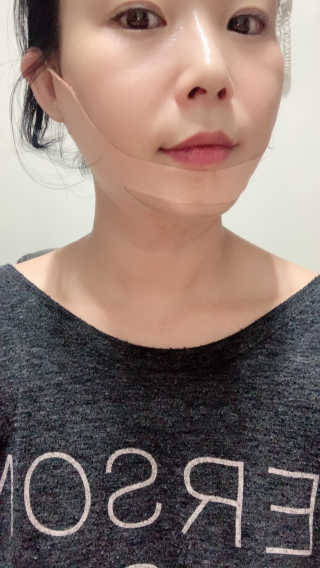 아이디플라코스메틱 아이디 페이스핏 마이너스 밴드 — 5점을 준 리뷰어가 2019년 10월 올린 사용 사진