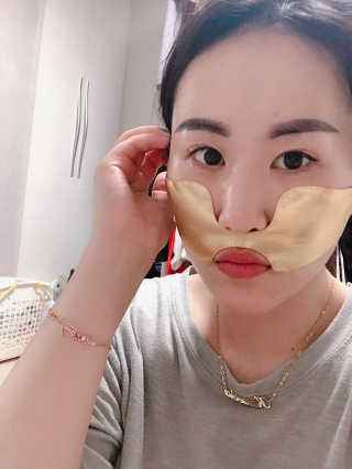 [스케덤] 상악밴드 — 3점을 준 리뷰어가 2019년 7월 올린 사용 사진