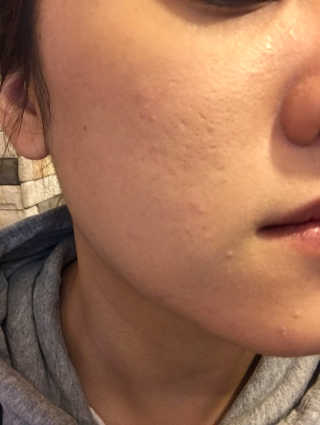 킴수희님이 올린 리뷰 사진 2