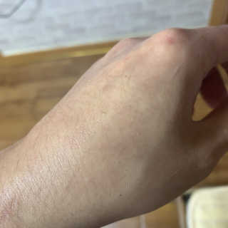 약해진 피부엔 닥터라플레 올인원로션 — 3.5점을 준 리뷰어가 2019년 12월 올린 사용 사진