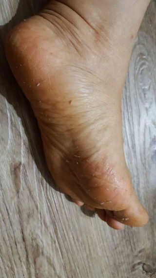 아미니 릴렉싱 풋 필링 스프레이 — 5점을 준 리뷰어가 2019년 3월 올린 사용 사진