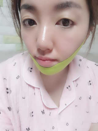스케덤 시카 리프팅밴드 — 5점을 준 리뷰어가 2019년 5월 올린 사용 사진