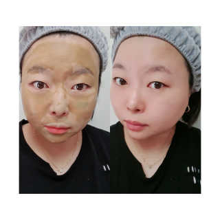 플러스셀라 시카골드 클렌징바 화산재팩 세트 — 5점을 준 리뷰어가 2020년 3월 올린 사용 사진