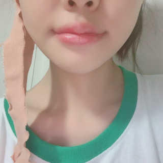 아이디플라코스메틱 아이디 페이스핏 마이너스 밴드 — 4.5점을 준 리뷰어가 2019년 9월 올린 사용 사진