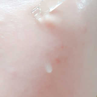 시카고 시카 더블 이펙트 앰플 30ml 기획세트 — 5점을 준 리뷰어가 2018년 8월 올린 사용 사진