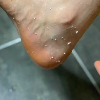 아미니 릴렉싱 풋 필링 스프레이 — 5점을 준 리뷰어가 2019년 6월 올린 사용 사진