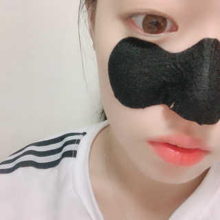 미팩토리 3단 돼지코팩 1box + 3단 흑돼지코팩 1box — 5점을 준 리뷰어가 2019년 8월 올린 사용 사진
