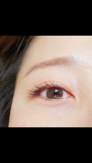Viewty Skin and Lash [ViewtySkin＆Lash] 종아리 림프순환 부종관리 — 5점을 준 리뷰어가 2019년 2월 올린 사용 사진