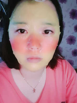 정찬우 꽐라만시 [꽐라마쓰]7가지 자연유래 오일 피부해장 마스크팩 — 5점을 준 리뷰어가 2019년 6월 올린 사용 사진