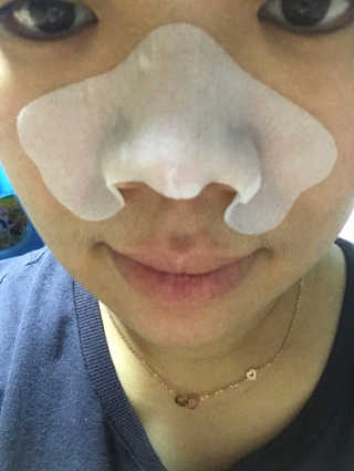 나이팅게일 TAKO PACK NOSE [문어코팩] — 3.5점을 준 리뷰어가 2017년 3월 올린 사용 사진