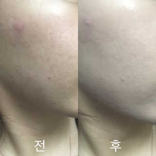 쏘히님이 올린 리뷰 사진 3