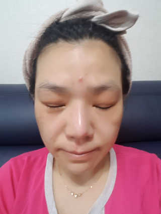 셀라피 에이리페어플러스크림 — 5점을 준 리뷰어가 2018년 4월 올린 사용 사진