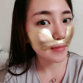 [스케덤] 상악밴드 — 5점을 준 리뷰어가 2019년 6월 올린 사용 사진