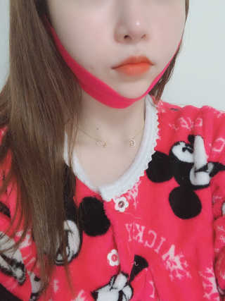 스케덤 펩타이드 리프팅밴드 — 3.5점을 준 리뷰어가 2019년 4월 올린 사용 사진