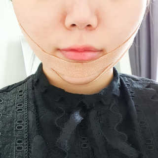 아이디플라코스메틱 아이디 페이스핏 마이너스 밴드 — 4점을 준 리뷰어가 2020년 1월 올린 사용 사진