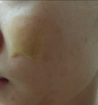 보타니티 [홍]조[진]정[결]케어 플라본 세럼 — 4.67점을 준 리뷰어가 2018년 5월 올린 사용 사진