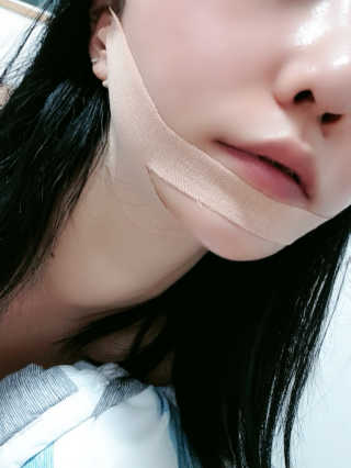 아이디플라코스메틱 아이디 페이스핏 마이너스 밴드 — 5점을 준 리뷰어가 2019년 9월 올린 사용 사진