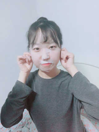 [더마허브] 주사팩 5종, 물광,백옥,태반,신데렐라 등 — 4점을 준 리뷰어가 2018년 3월 올린 사용 사진