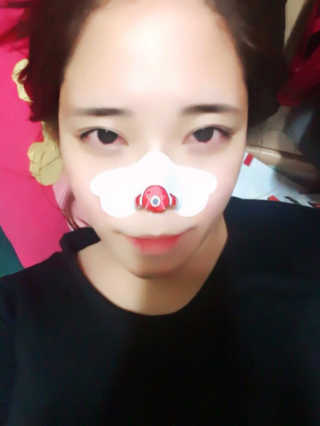 나이팅게일 TAKO PACK NOSE [문어코팩] — 3점을 준 리뷰어가 2017년 4월 올린 사용 사진