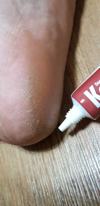 케라셀 풋크림 케라셀 인텐시브 풋 리페어 — 5점을 준 리뷰어가 2019년 10월 올린 사용 사진