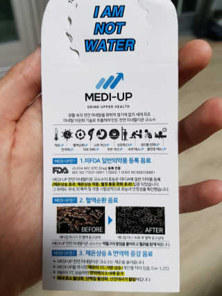 메디덴코 메디업 — 4점을 준 리뷰어가 2018년 3월 올린 사용 사진