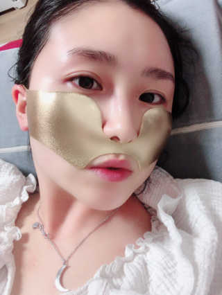 [스케덤] 상악밴드 — 3.5점을 준 리뷰어가 2019년 7월 올린 사용 사진