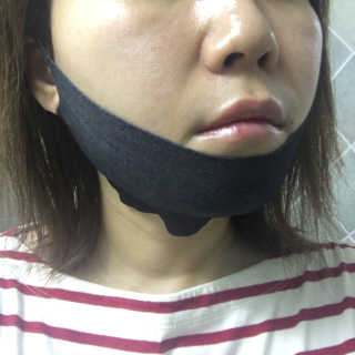 어웨이크어슬립 어슬립 페이스 리프트업 밴드 — 4.67점을 준 리뷰어가 2018년 7월 올린 사용 사진