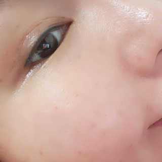 세포랩 바이오제닉 에센스 30ml 특별팩 — 5점을 준 리뷰어가 2018년 5월 올린 사용 사진